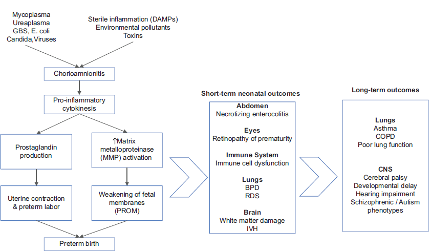 Inflamatory process in chorioamnionitis and their neonatal impact. GBS: Group B Streptococcus, DAMP: Damage-associated molecular patterns, PROM: Premature rupture of membranes, BPD: Bronchopulmonary dysplasia, RDS: Respiratory distress syndrome, IVH: Intraventricular hemorrhage, COPD: Chronic obstructive pulmonary disease, CNS: Central Nervous System.